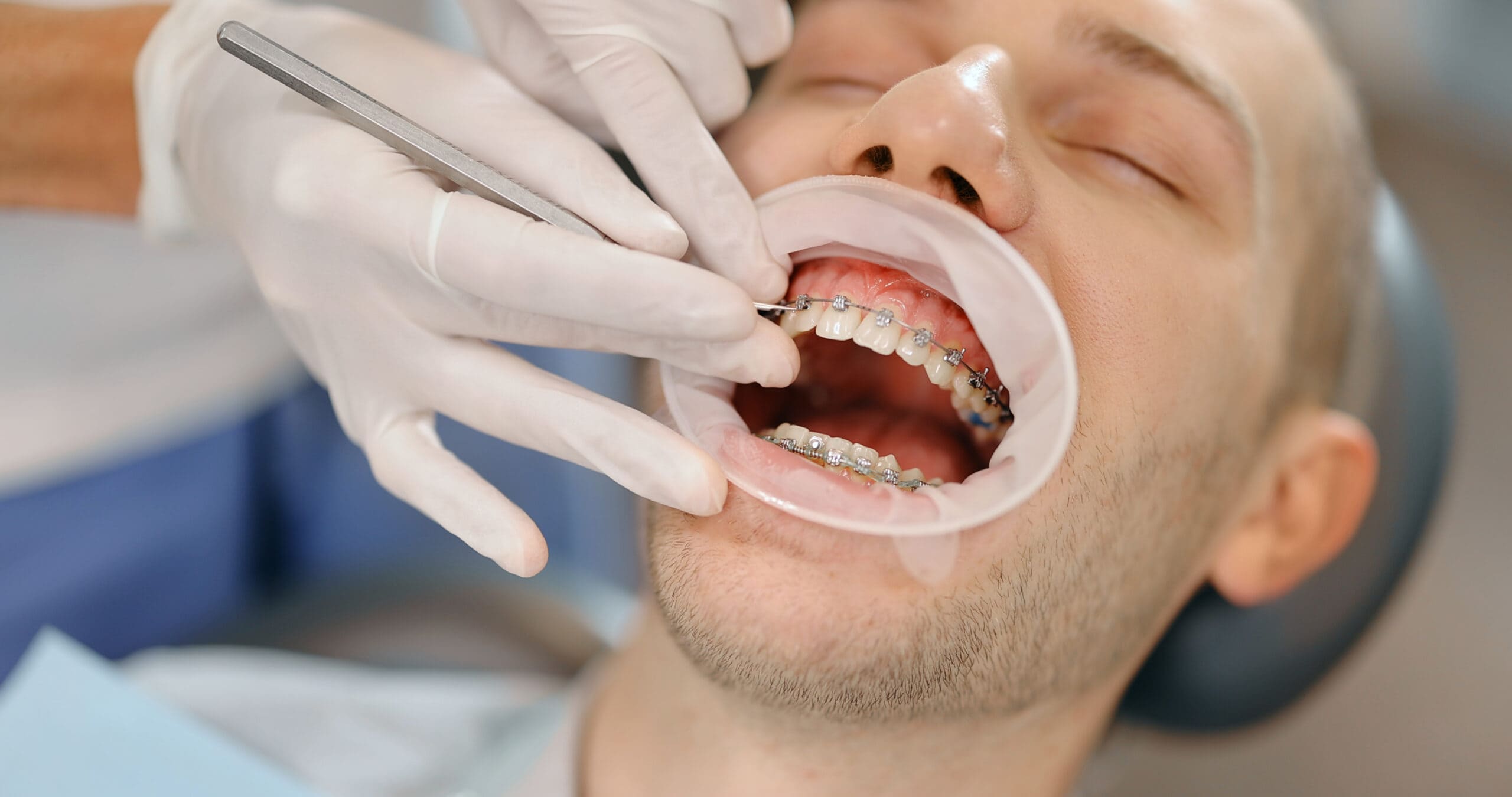 Dental Clinic Video Editing Services 2 Dental Clinic Video Editing